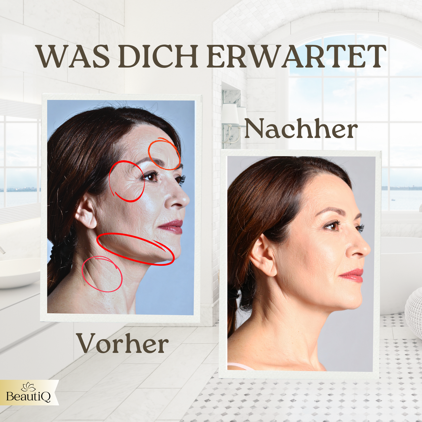 Golden Glow | EMS & Radiofrequenz gegen Falten, Tiefenwirksames Anti Aging
