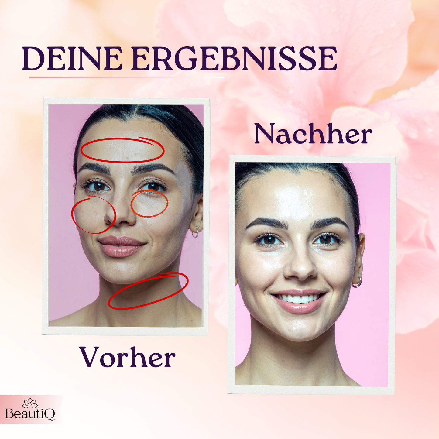 Velluré Glow | Anti-Aging, EMS, Vibration + Lichttherapie für Gesicht & Hals