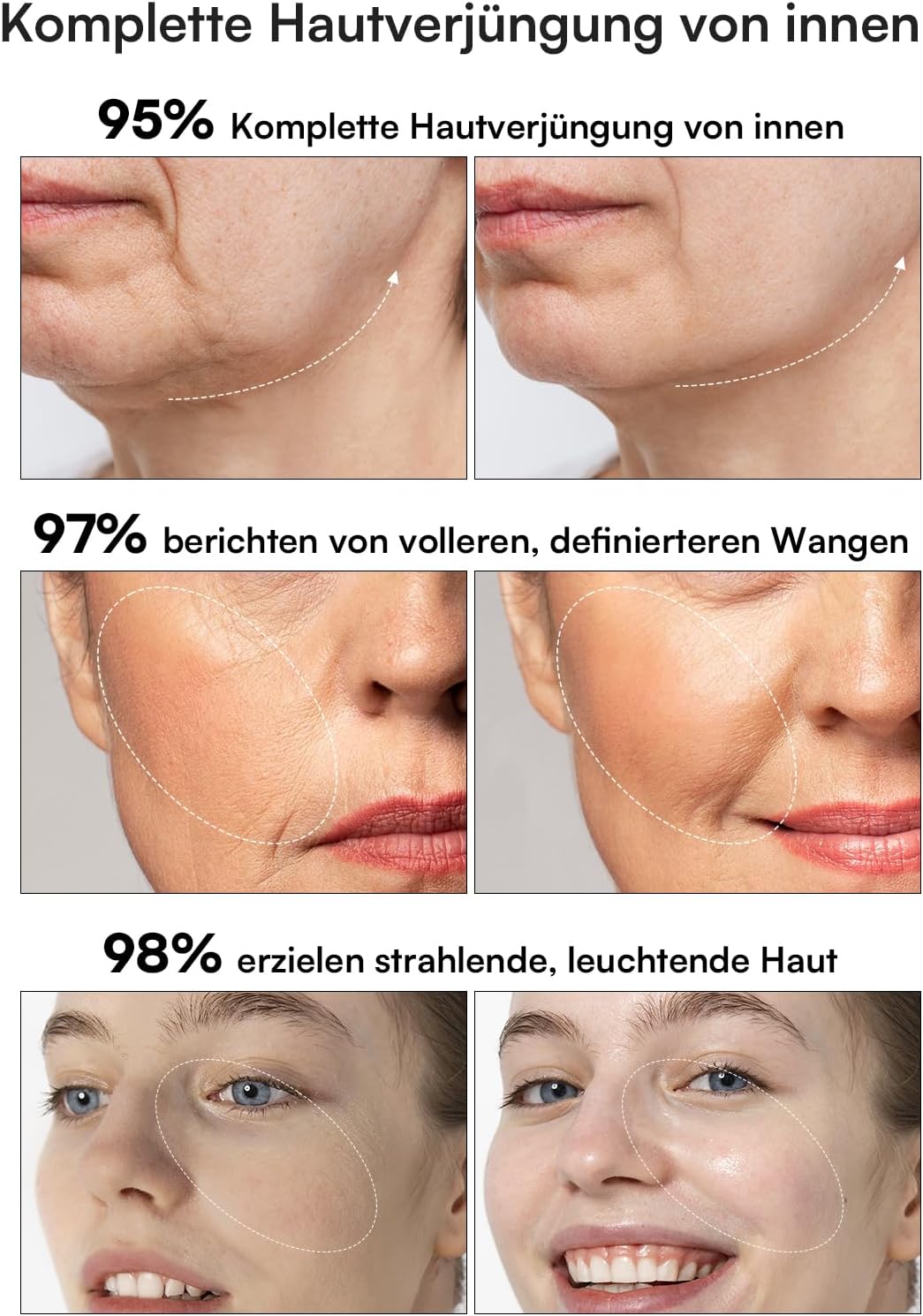 Beauty Lifting Flair | 3-in-1 Premium Anti-Aging Gerät mit EMS & Hochfrequenz