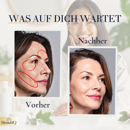 BeautiQ RF Lumera – Das 6-in-1 Anti-Aging-System für zeitlose Schönheit & den ultimativen Glow